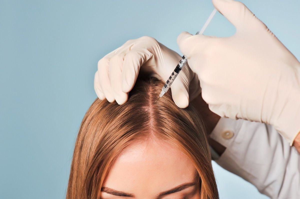 Проведение процедуры мезотерапии волос
