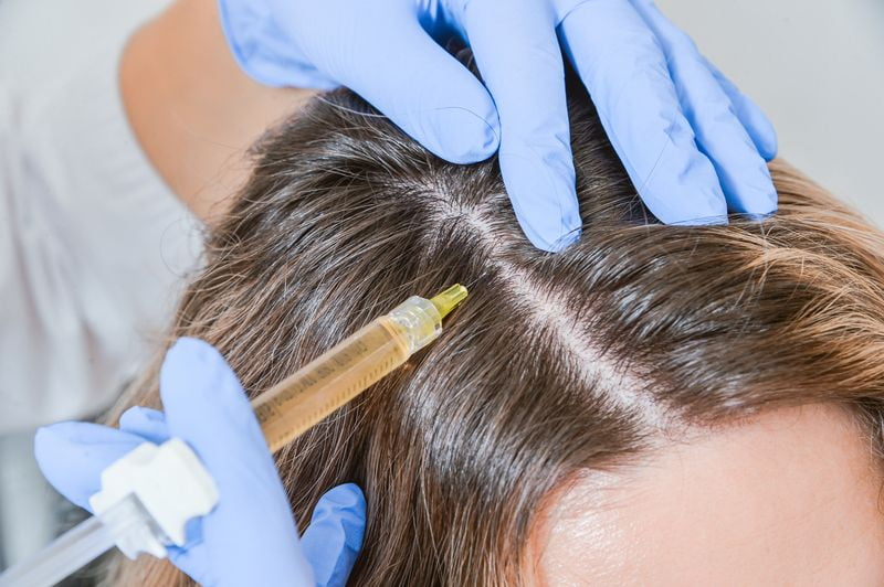 Проведение процедуры плазмолифтинга для волос